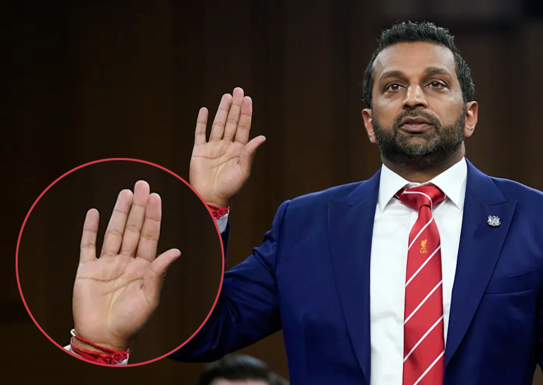 FBI Director Kash Patel and a closeup of his hand